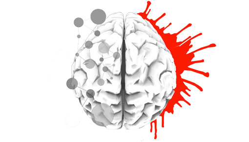 Design d'un cerveau